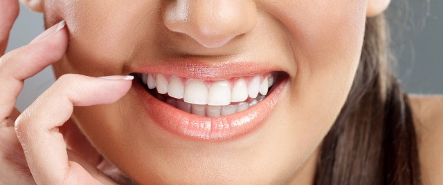 carillas dental